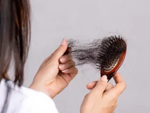 انواع روش های درمان ریزش مو