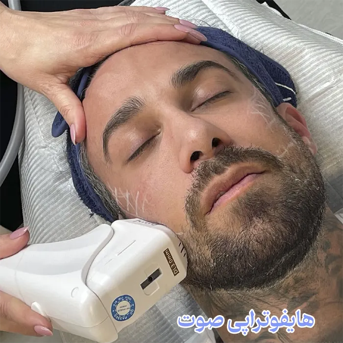 هایفوتراپی صورت