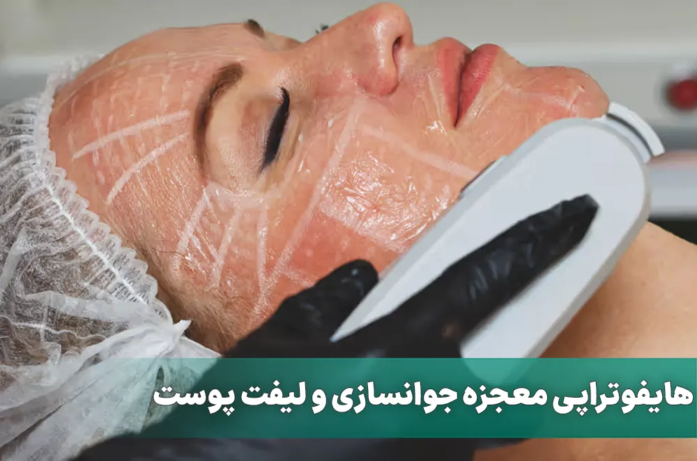 هایفوتراپی صورت