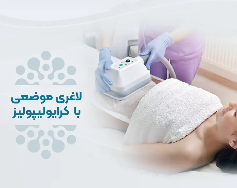 کرایولیپولیز