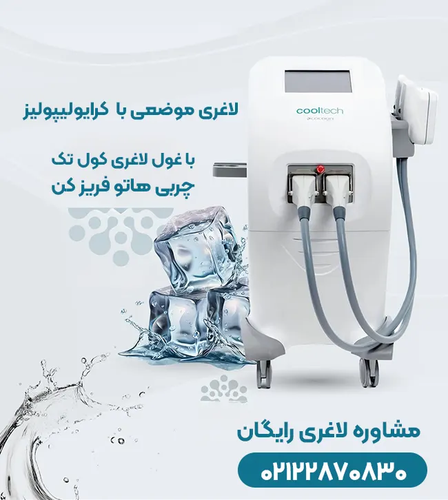 کرایولیپولیز کول تک