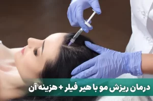 درمان ریزش مو با هیر فیلر