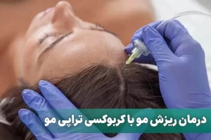 کربوکسی تراپی مو