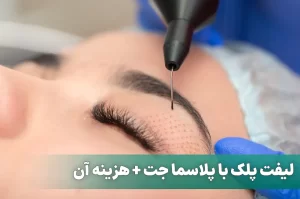 لیفت پلک با پلاسما جت