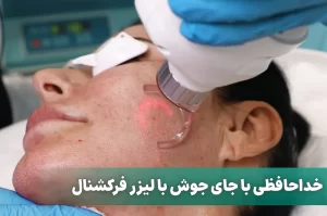 خداحافظی با جای جوش با لیزر فرکشنال