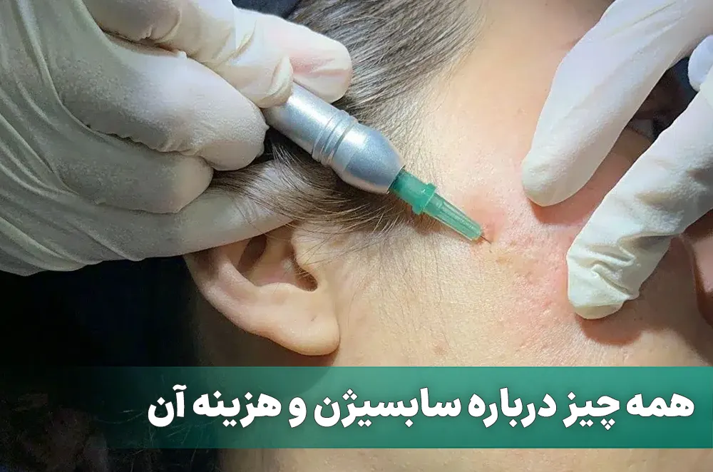 سابسیژن پوست