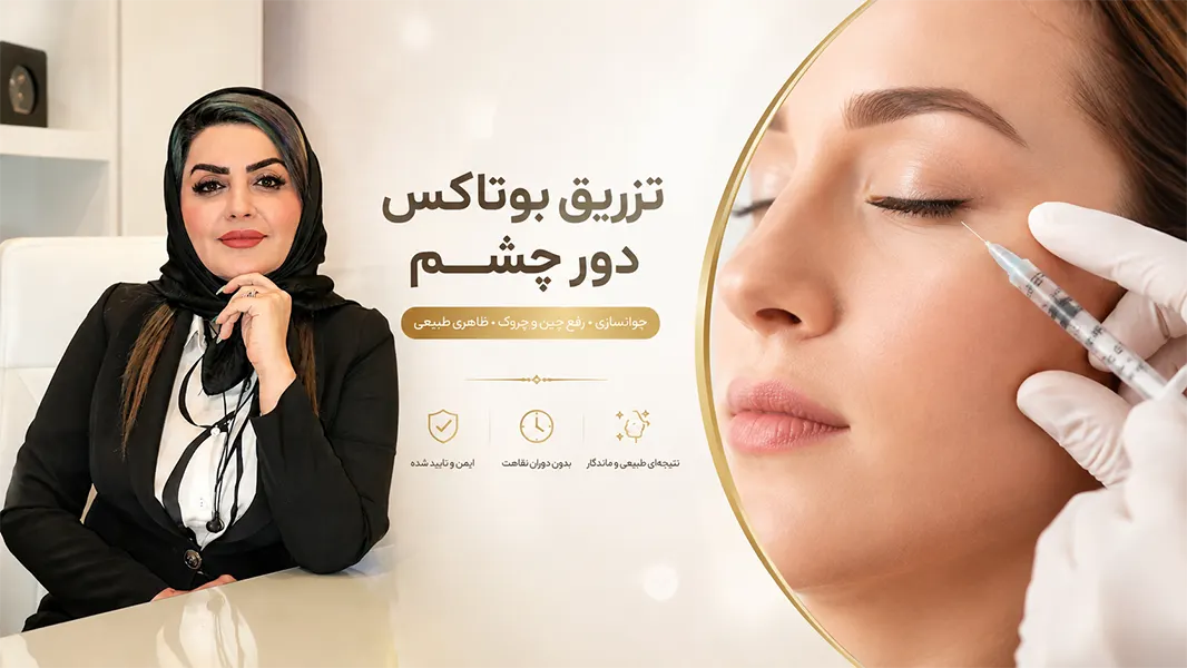 درمان قطعی چین و چروک های دور چشم با بوتاکس