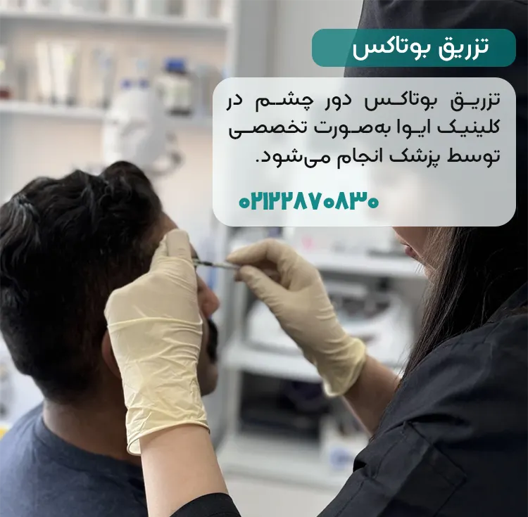 تزریق بوتاکس دور چشم