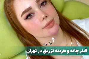 تزریق فیلر چانه