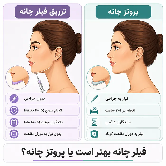 فیلر چانه بهتر است یا پروتز چانه