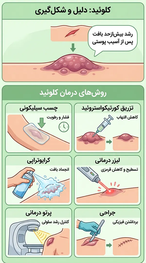 درمان قطعی کلوئید یا گوشت اضافه