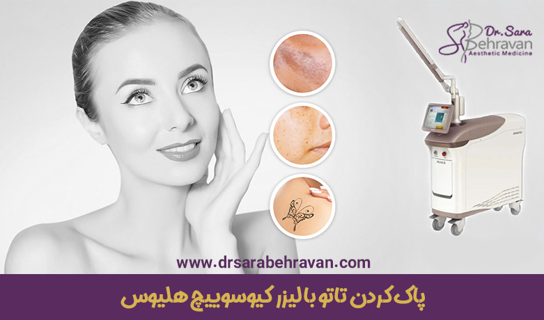 پاک-کردن-تاتو-با-لیزر-کیوسوییچ