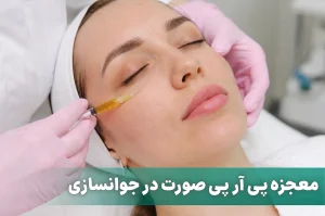 پی آر پی صورت