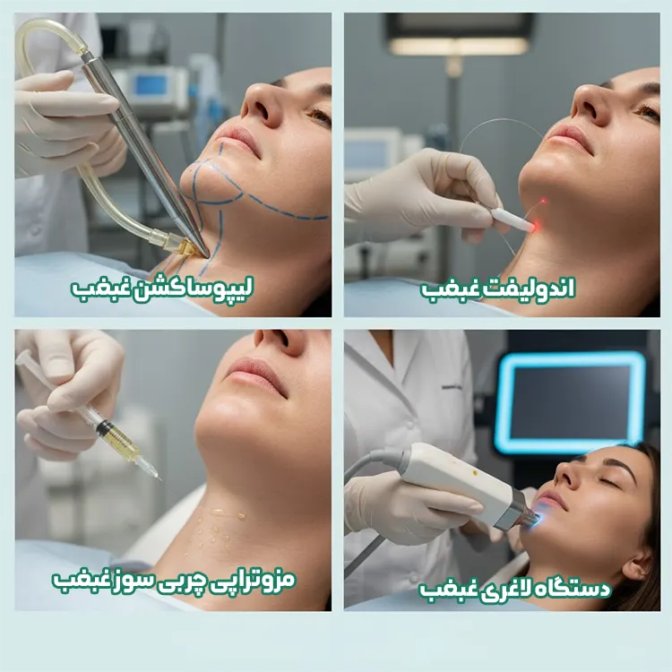 مقایسه ساکشن غبغب با مزوتراپی، اندولیفت و دستگاه لاغری