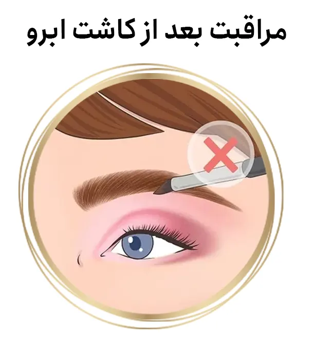 مراقبت بعد کاشت ابرو