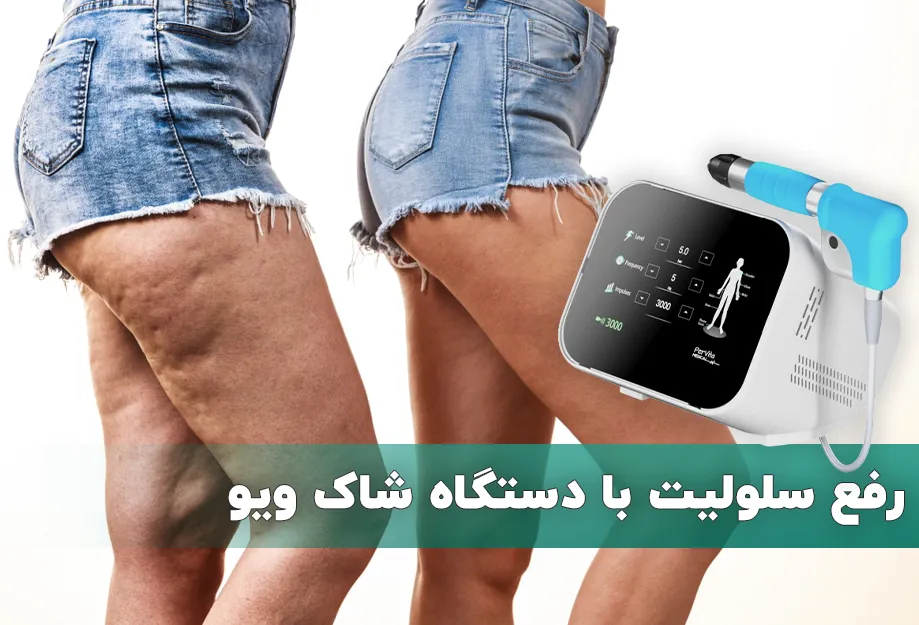 رفع سلولیت با دستگاه شاک ویو
