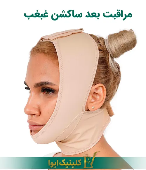 مراقبت بعد ساکشن غبغب