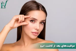 مراقبت بعد کاشت ابرو