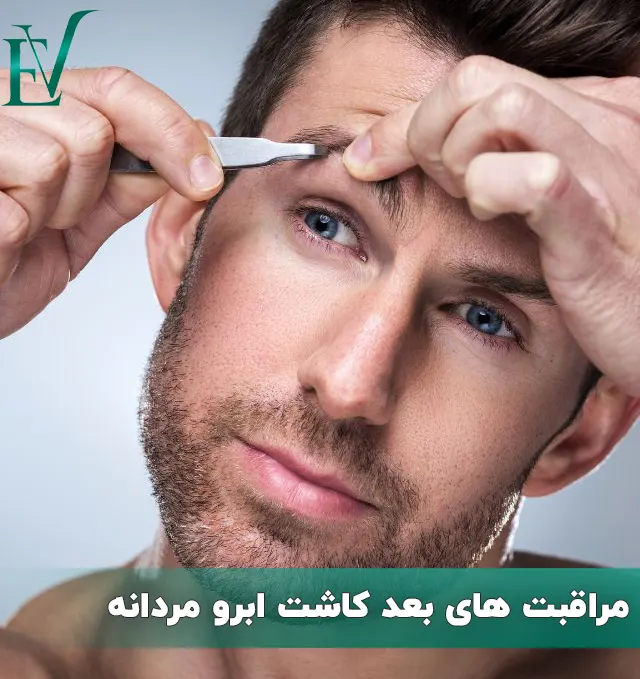 مراقبت های بعد کاشت ابرو مردانه