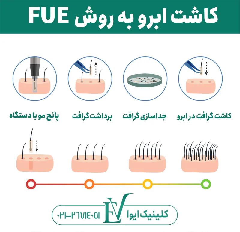 کاشت ابرو fue