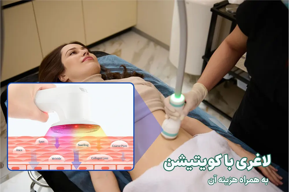 هزینه لاغری با دستگاه کویتیشن