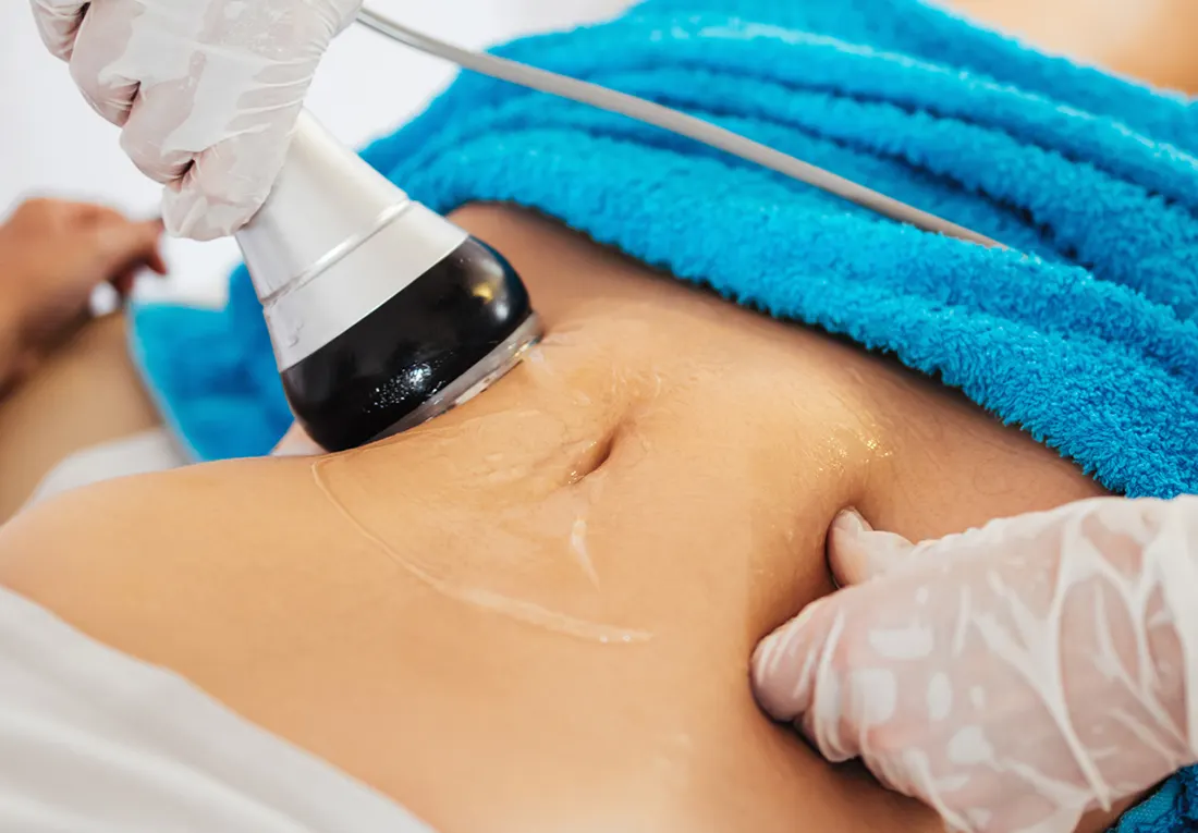 هزینه لاغری با دستگاه آر اف