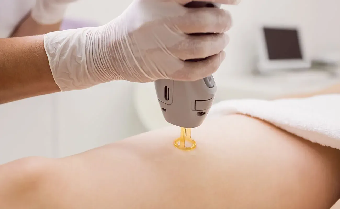 کلینیک لیزر موهای زائد