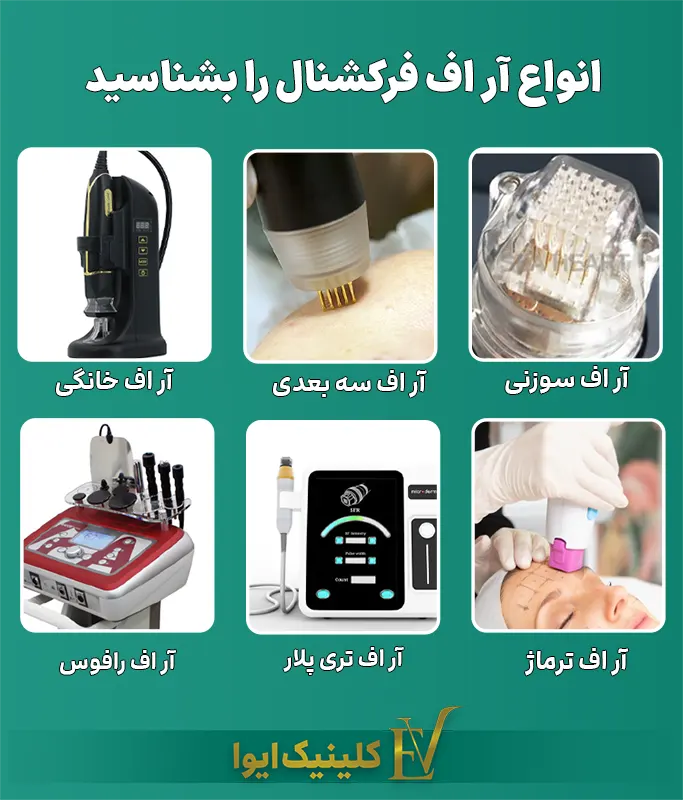 انواع آر اف فرکشنال