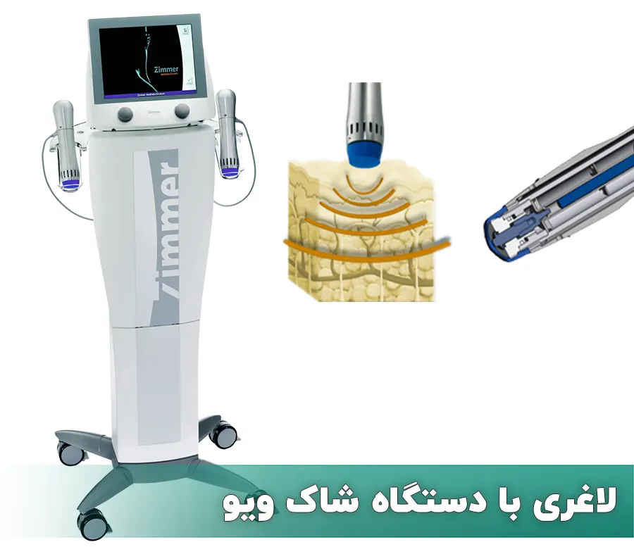 دستگاه شاک ویو