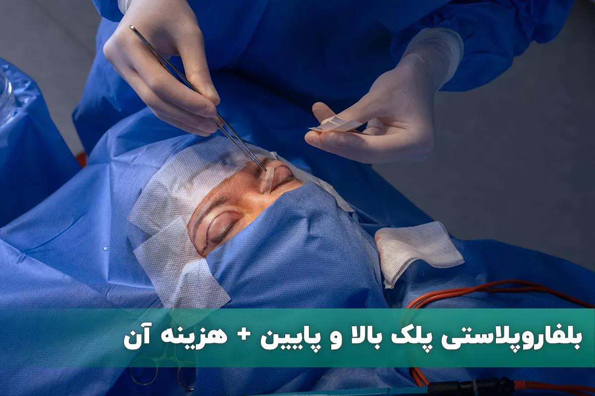 عمل بلفاروپلاستی