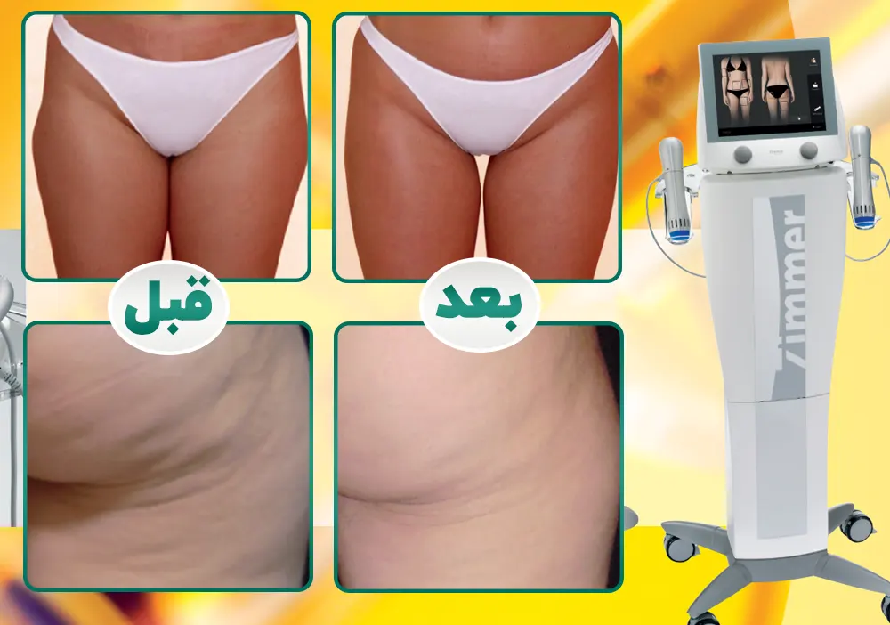 لاغری با شاک ویو