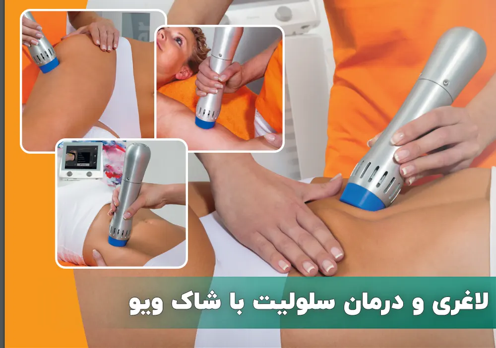 لاغری و درمان سلولیت با شاک ویو