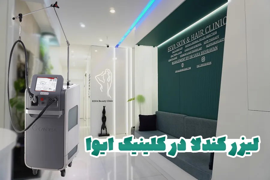 ایوا کلینیک موی زائد در تهران