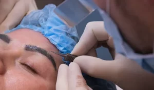 نحوه کاشت ابرو