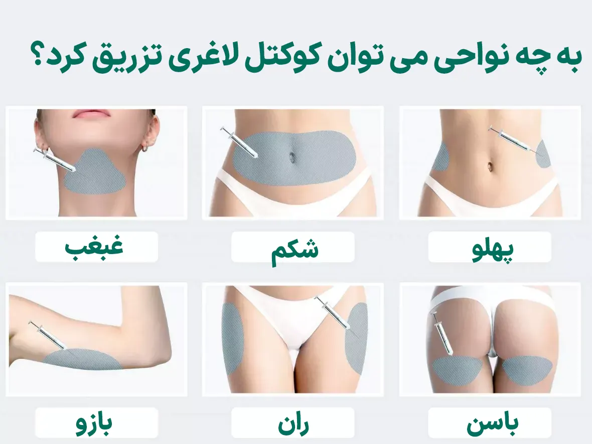 کوکتل لاغری را به چه نواحی می توان تزریق کرد؟