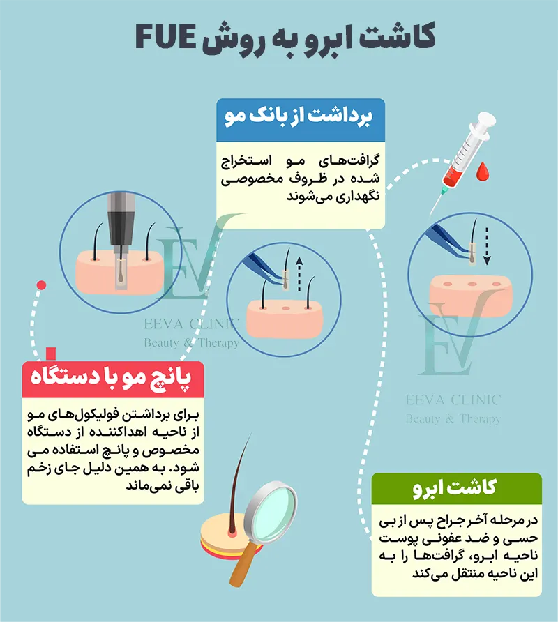 کاشت ابرو fue
