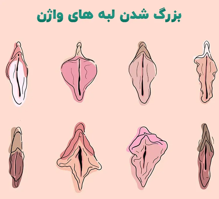از کجا بفهمیم واژن تنگی داریم