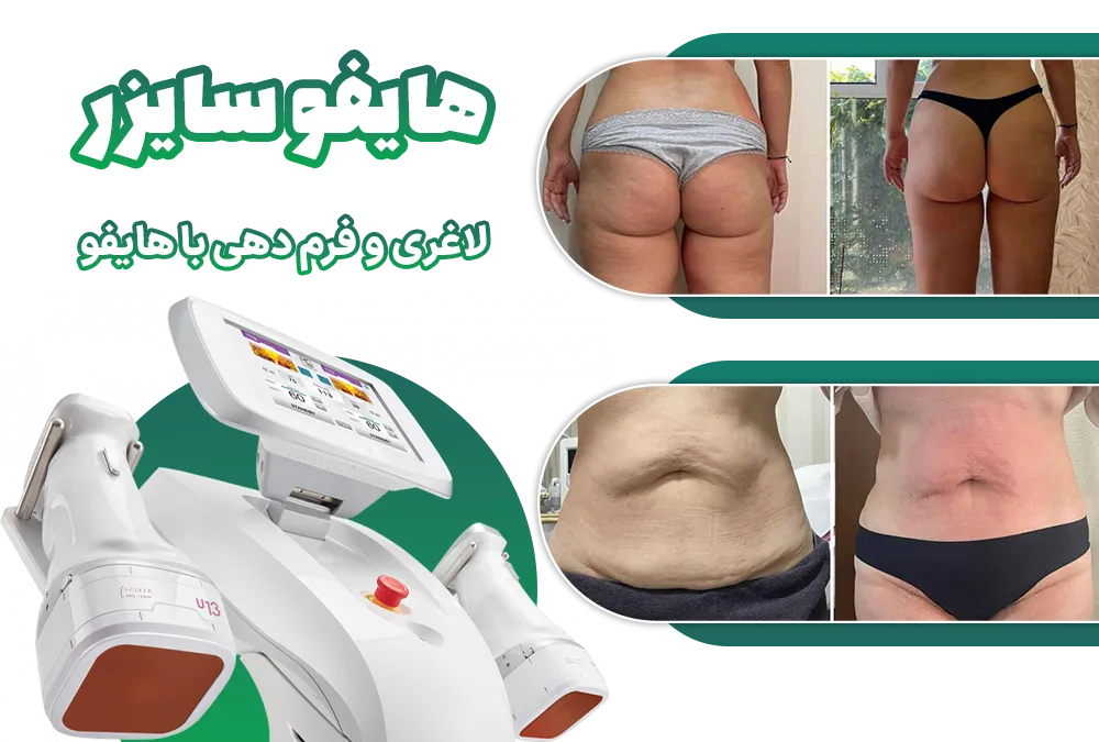 لاغری با هایفو