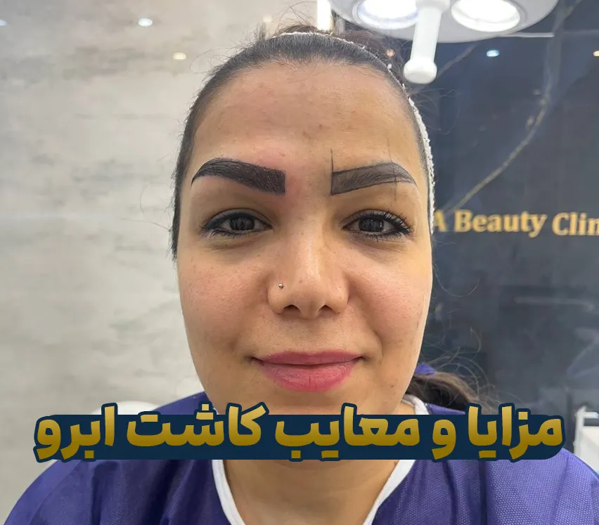 مزایا و معایب کاشت ابرو