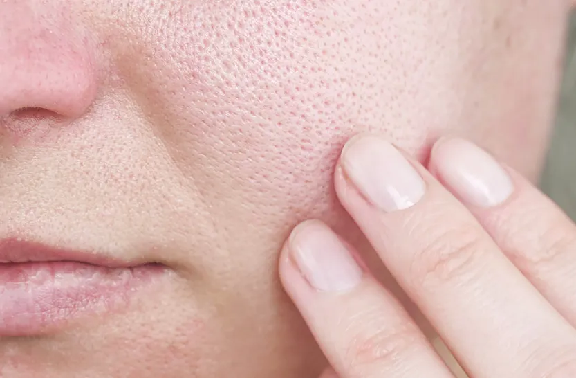 منافذ باز پوست