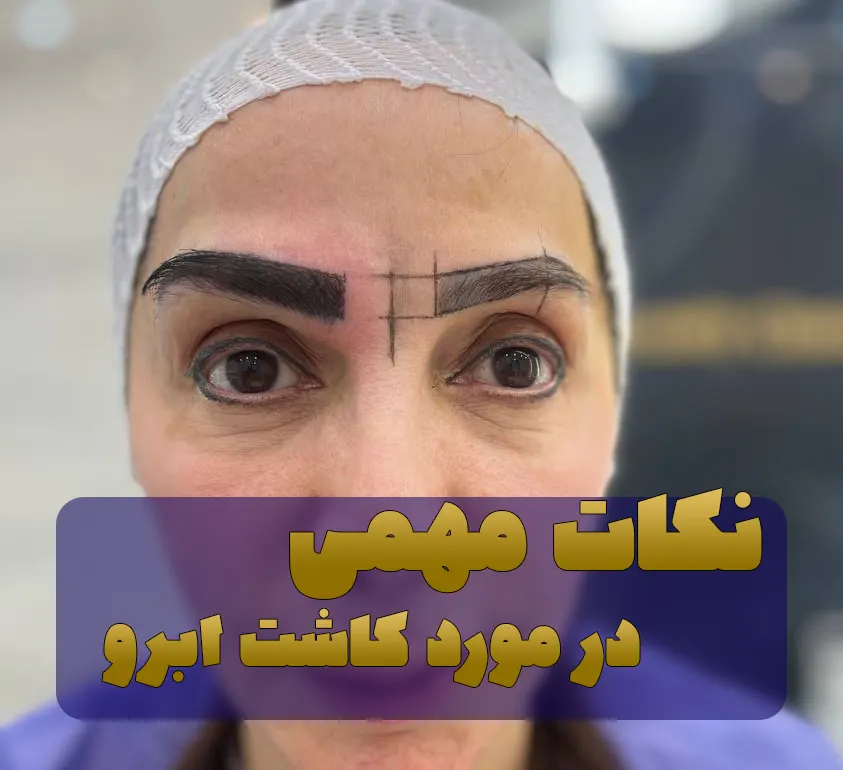 نکات مهمی در مورد کاشت ابرو