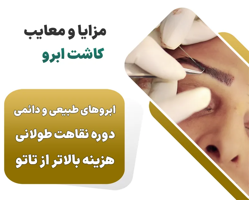 مزایا و معایب کاشت ابرو