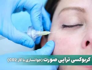 کربوکسی تراپی صورت