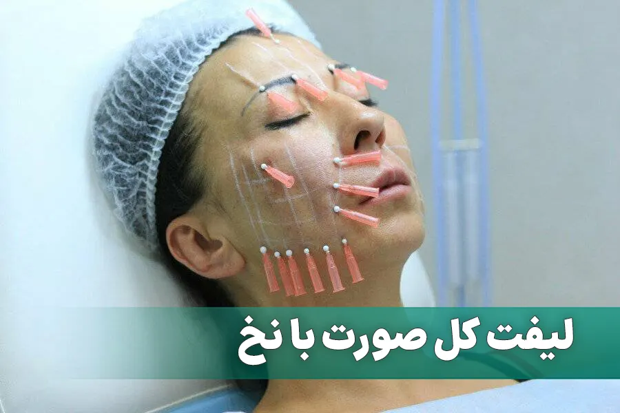 لیفت کل صورت با نخ