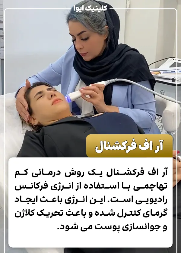 آر اف فرکشنال