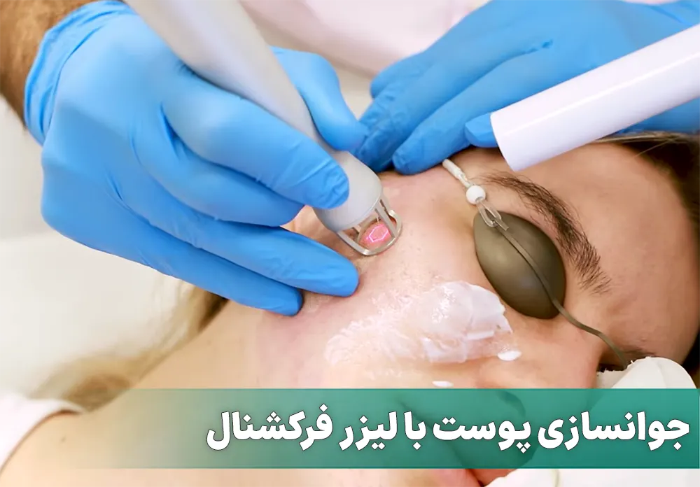 جوانسازی با لیزر فرکشنال