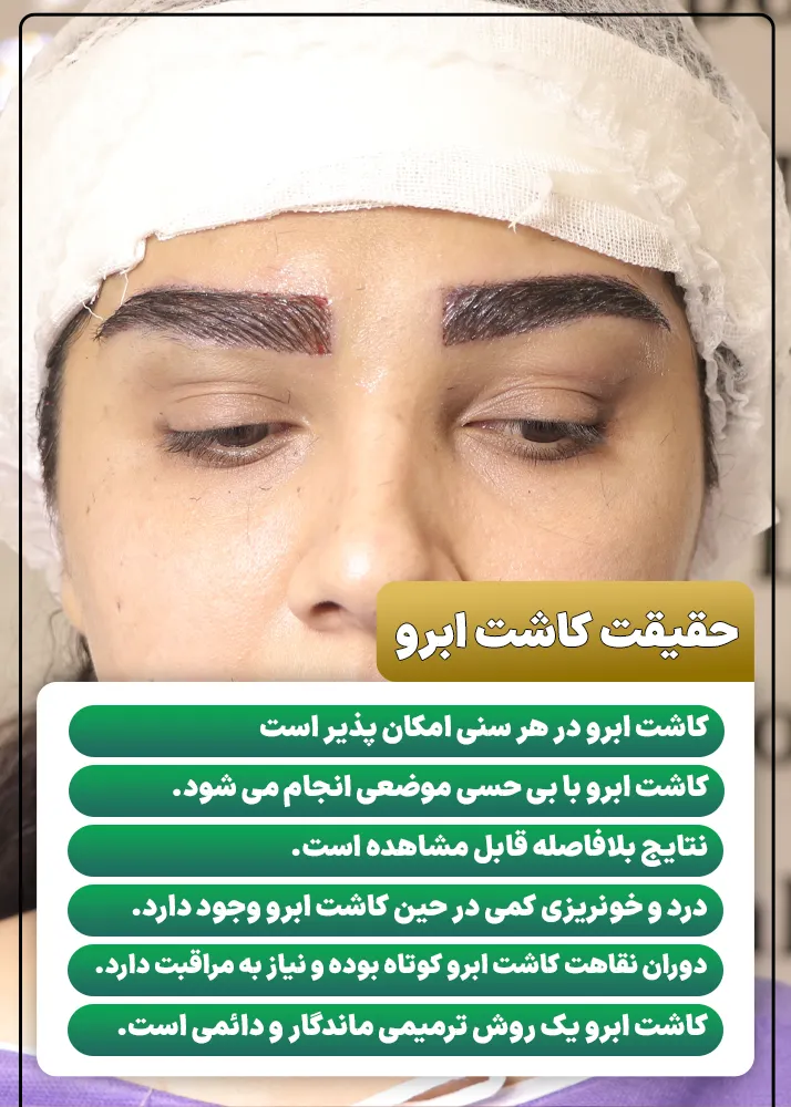حقیقت ها در مورد کاشت ابرو