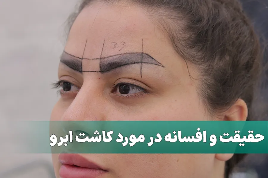 حقیقت و افسانه در مورد کاشت ابرو