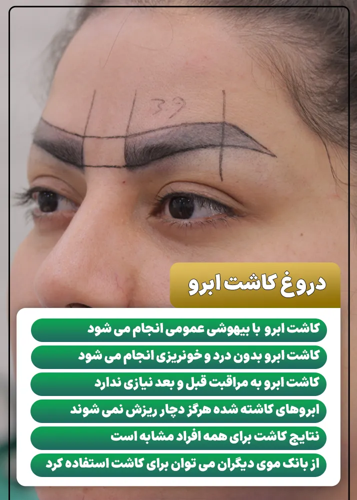 افسانه و دروغ های کاشت ابرو