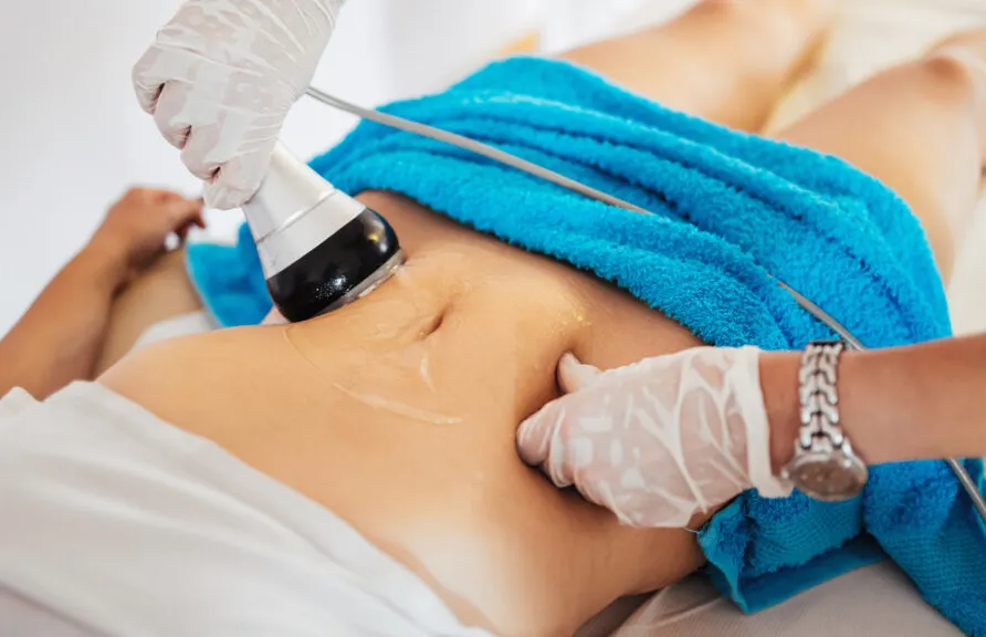 لاغری با دستگاه آر اف